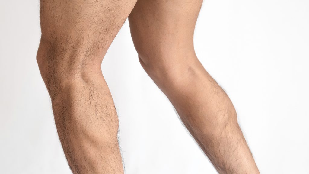 Calf Implants