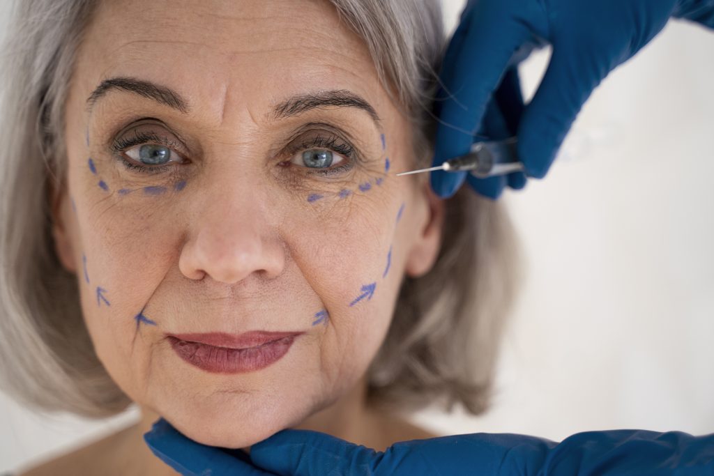 Fat Grafting for Face